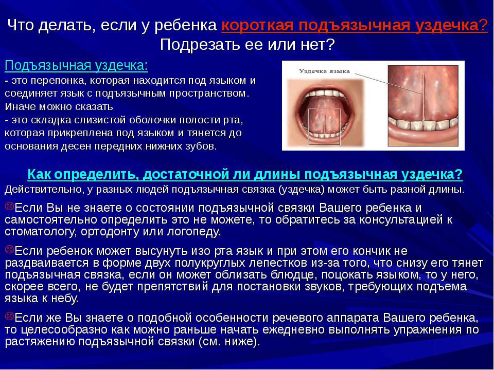 Что делать, если у ребенка короткая подъязычная уздечка? - Класс учебник | Академический школьный учебник скачать | Сайт школьных книг учебников uchebniki.org.ua