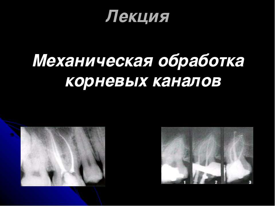 Механическая обработка корневых каналов - Класс учебник | Академический школьный учебник скачать | Сайт школьных книг учебников uchebniki.org.ua