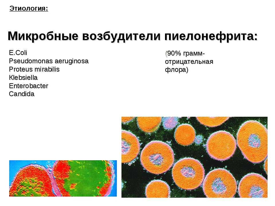 Микробные возбудители пиелонефрита - Класс учебник | Академический школьный учебник скачать | Сайт школьных книг учебников uchebniki.org.ua